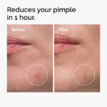 The Ordinary Sulfur 10% Powder-to-Cream Concentrate Acne Spot Treatment - Image 4