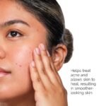 The Ordinary  The Acne Set with Salicylic Acid - Image 3